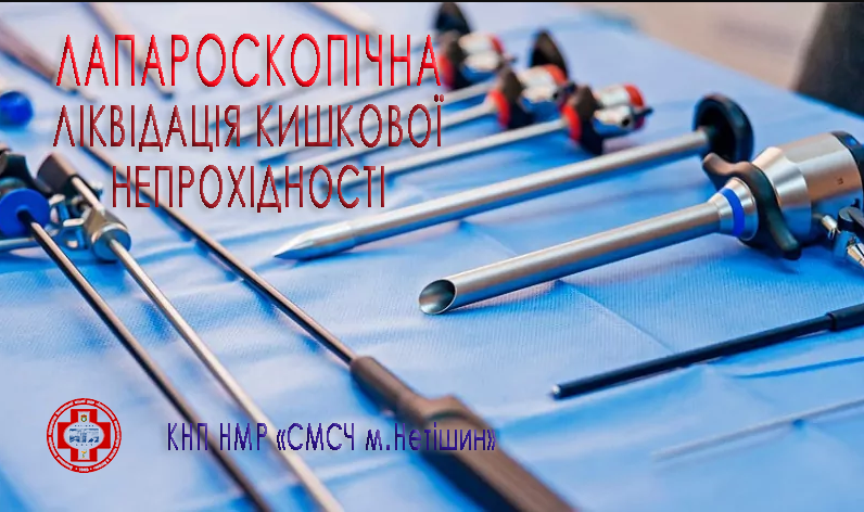 Вперше та успішно виконано лапароскопічну ліквідацію кишкової непрохідності