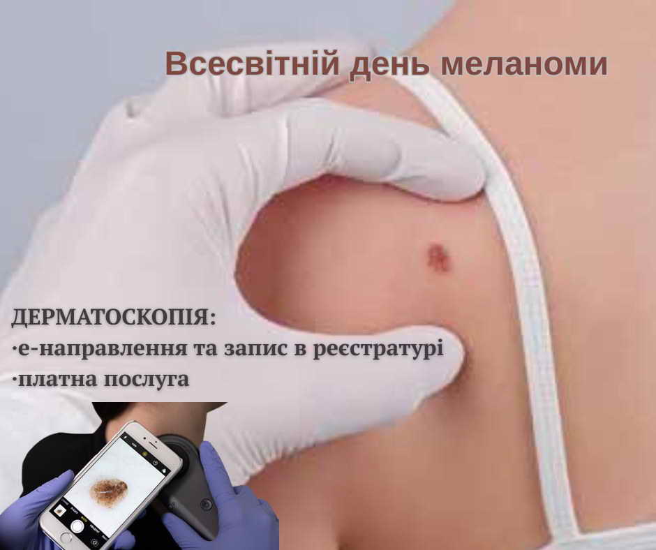 Всесвітній день меланоми