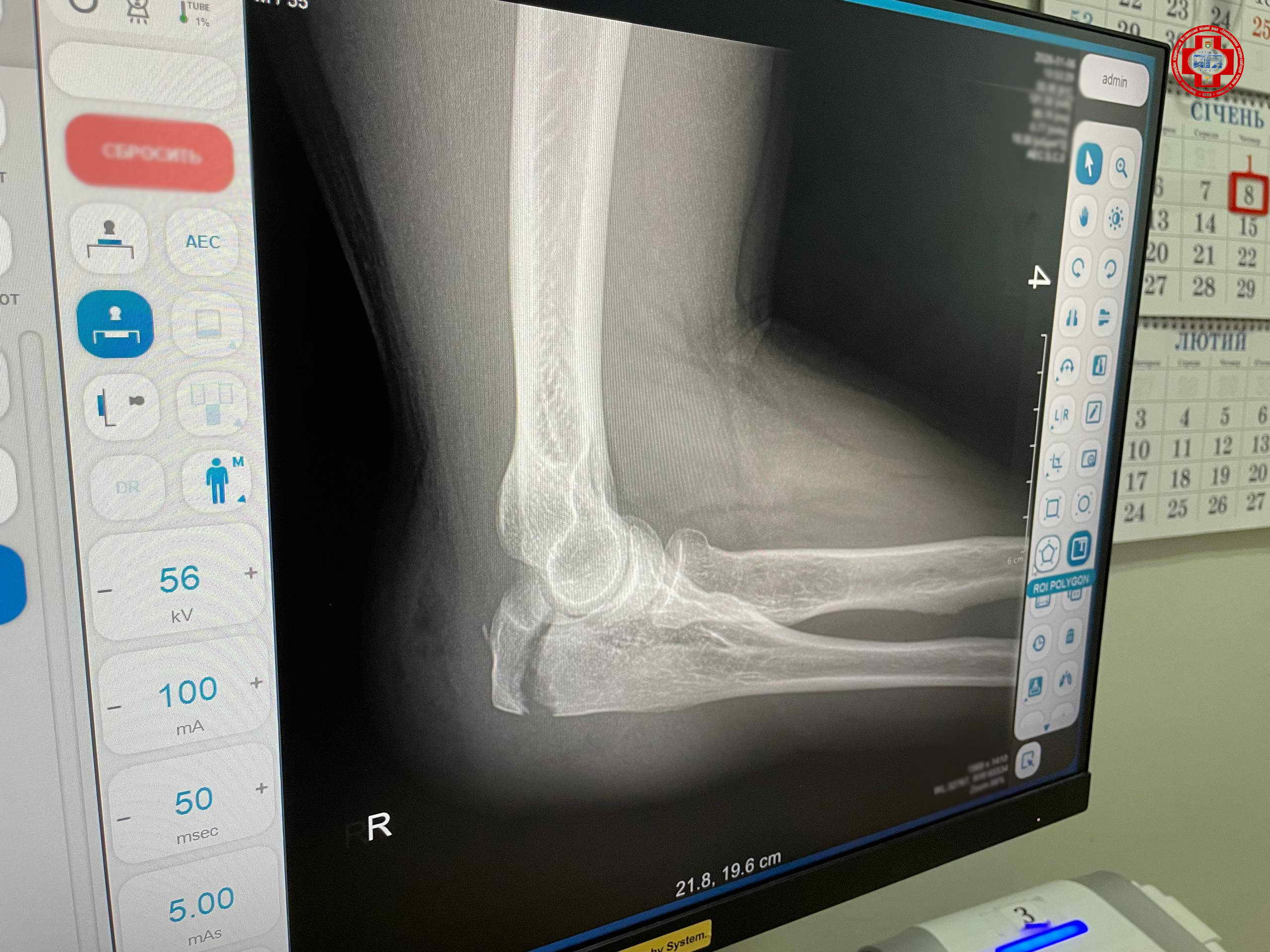 Зріс ризик падінь і травм